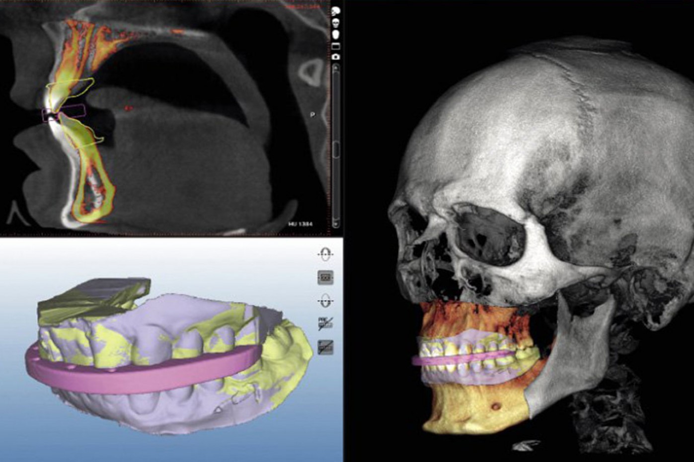 Dental Scan 3D